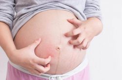 Mẹ bầu cần thận trọng khi chữa nổi mề đay khi mang thai