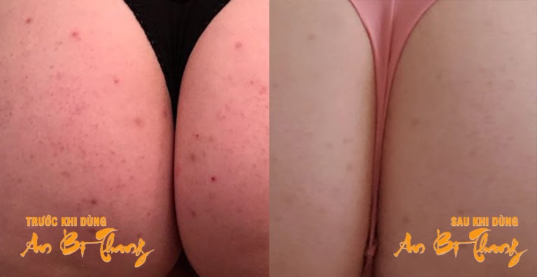 Phản hồi của chị Hải Hà