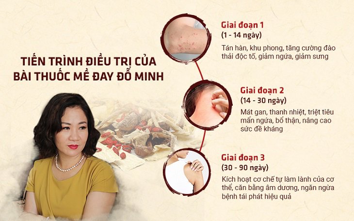 Hiệu quả của bài thuốc mề đay Đỗ Minh