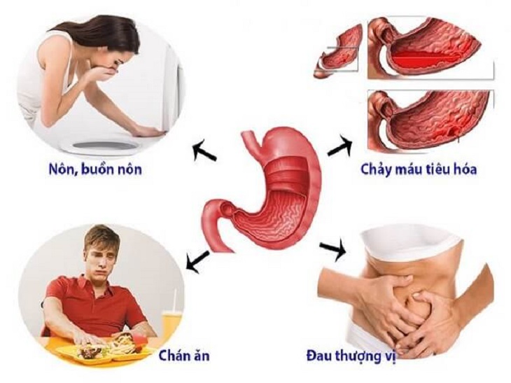 Đau dạ dày có mấy cấp độ