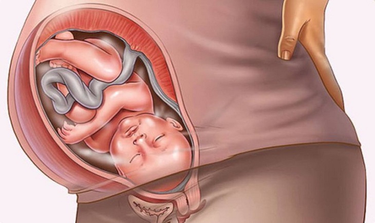 Bị viêm âm đạo có mang thai được không còn tùy thuộc vào mức độ nặng nhẹ của người bệnh