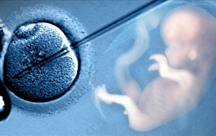 Áp dụng các biện pháp hỗ trợ sinh sản với phụ nữ đa nang buồng trứng