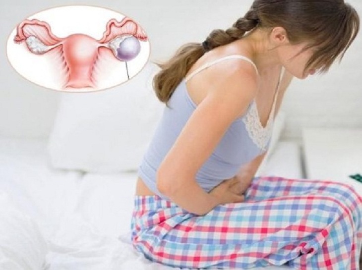 Nguyên nhân phụ nữ bị buồng trứng đa nang do rối loạn nội tiết tố trên trong cơ thể