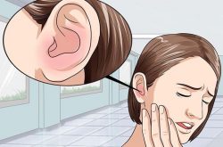 Chuyên gia giải đáp viêm xoang ù tai có chữa được không?
