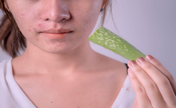 Nha đam có tác dụng làm mát, dưỡng da và trị mụn