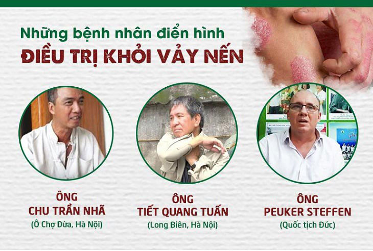 Các bệnh nhân điển hình điều trị khỏi vảy nến tại Thuốc dân tộc