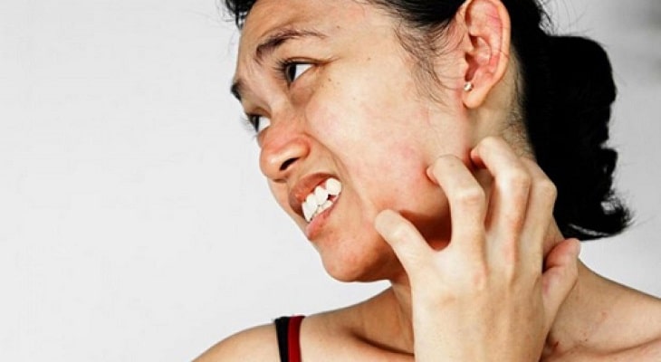 Những ai mắc bệnh gan đều có dấu hiệu ngứa da mặt và cổ, nổi mẩn