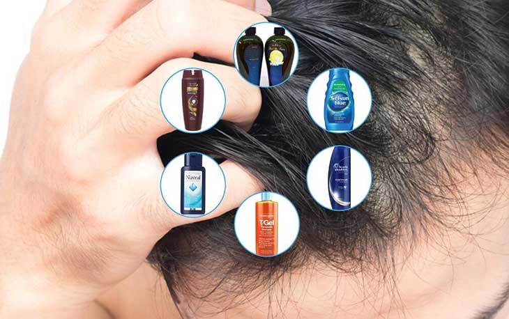 Top 9 loại dầu gội trị ngứa da đầu mang lại hiệu quả cao