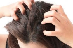 Ngứa da đầu là bệnh gì? Cách chữa
