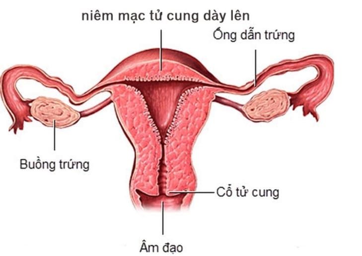 Hình ảnh cấu tạo hệ thống cơ quan sinh sản của phụ nữ