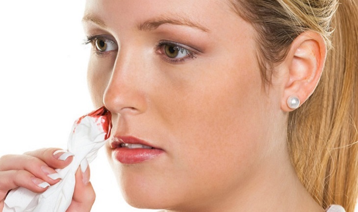 Viêm xoang chảy máu mũi do nhiều nguyên nhân gây ra