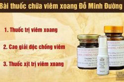 viem xoang do minh duong compressed