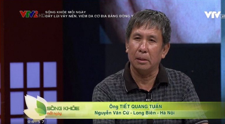 Ông Tiết Quang Tuấn điều trị thành công vảy nến nhờ bài thuốc Thanh bì Dưỡng can thang