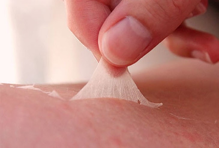 Phương pháp lột da giúp loại bỏ rạn da hiệu quả