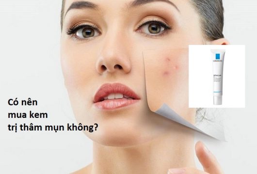 Có nên mua kem trị mụn giá học sinh không?