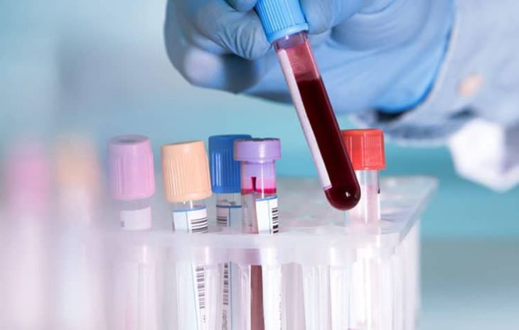 Xét nghiệm máu cũng có thể giúp bác sĩ xác định khả năng bị trĩ của bạn