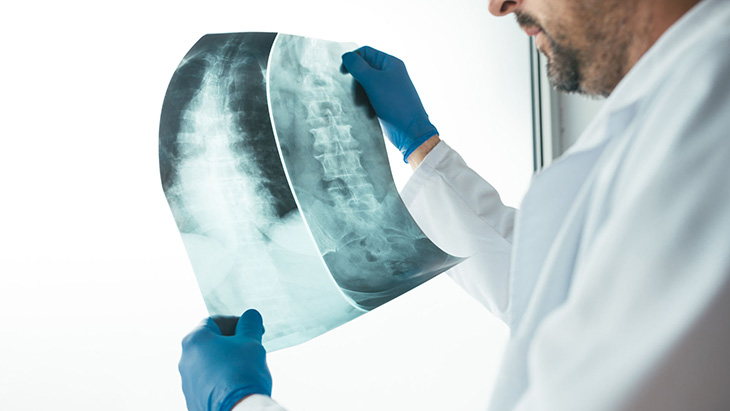 Phim chụp X quang giúp bác sĩ chẩn đoán bệnh