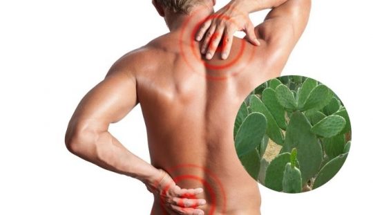 Trị gai cột sống bằng xương rồng