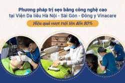 Viện Da liễu Hà Nội - Sài Gòn là một trong những địa chỉ áp dụng thành công phương pháp trị sẹo công nghệ cao