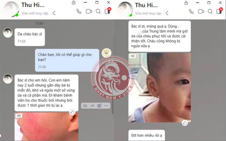 Mẹ của bé Việt Anh cảm thấy hài lòng về hiệu quả khi sử dụng Nhất Nam An Bì Thang khắc phục chàm sữa cho con