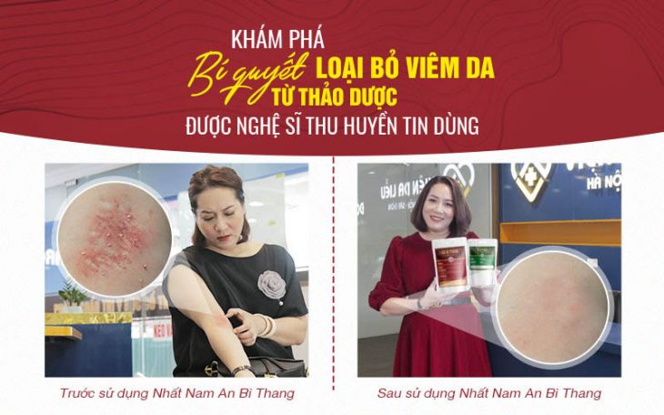Bài thuốc Nhất Nam An Bì Thang đã mang lại một làn da khỏe, đẹp cho nghệ sĩ Thu Huyền